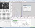 Foto Verwendet BRUKER MicroFlex LRF Zum Verkauf