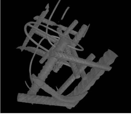 Foto Verwendet LINAC CT Scanner Zum Verkauf